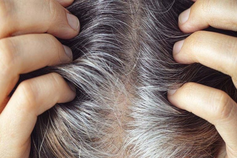 Para que serve aplicar vinagre de arroz nos cabelos grisalhos e como fazê-lo corretamente